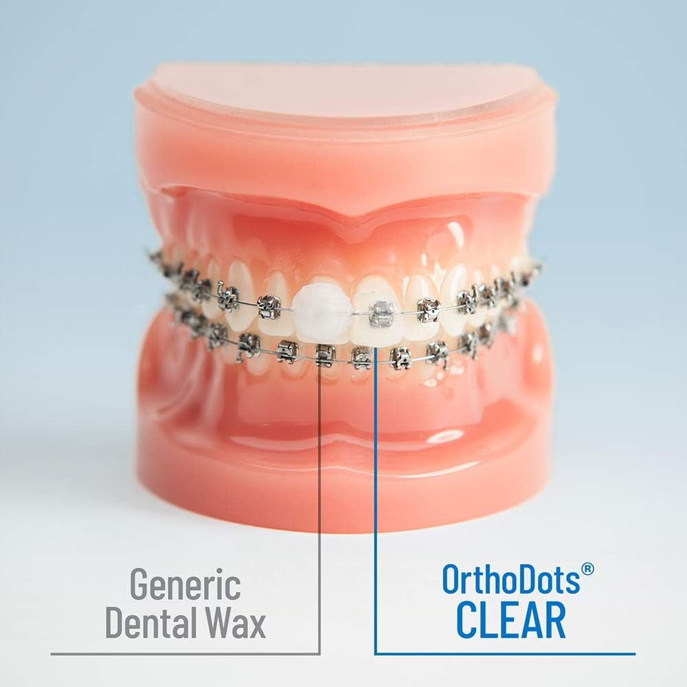 Orthodots CLEAR – 24-Hour Protection | Sticks Better than Dental Wax | Moisture Activated Braces Wax Alternative for Pain Caused by Braces, Clear Aligner Trays, and Other Orthodontic Appliances