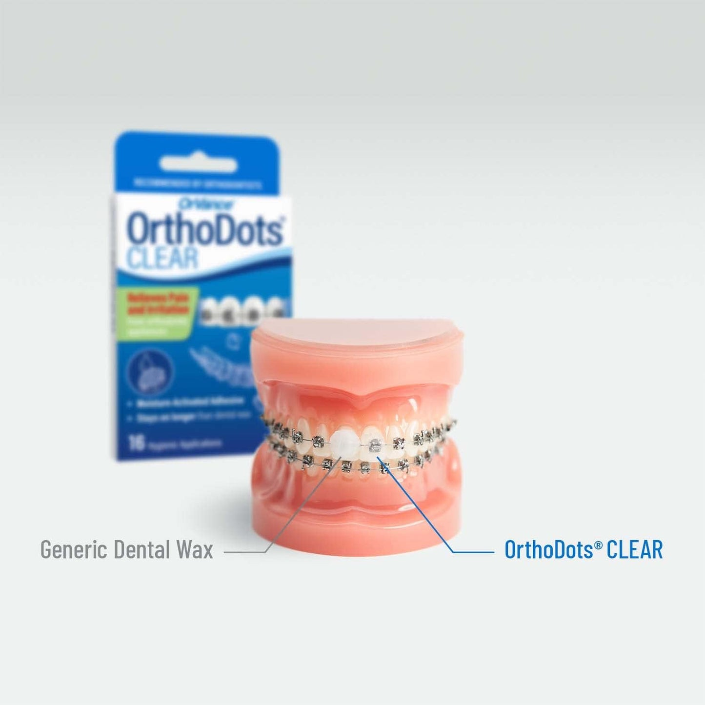 Orthodots CLEAR – 24-Hour Protection | Sticks Better than Dental Wax | Moisture Activated Braces Wax Alternative for Pain Caused by Braces, Clear Aligner Trays, and Other Orthodontic Appliances