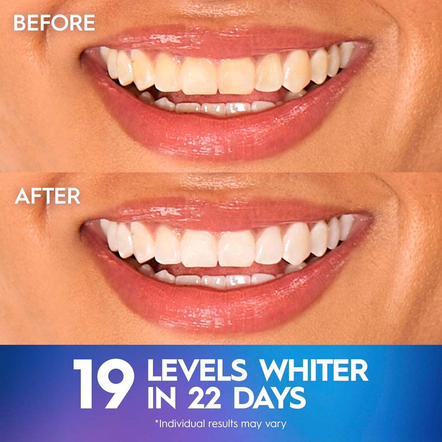 Get 19 Shades Whiter Smile: Professional 3D Teeth Whitening Strips Kit – Enamel-Safe Fast Whitener (22 Treatments, 44 Strips).