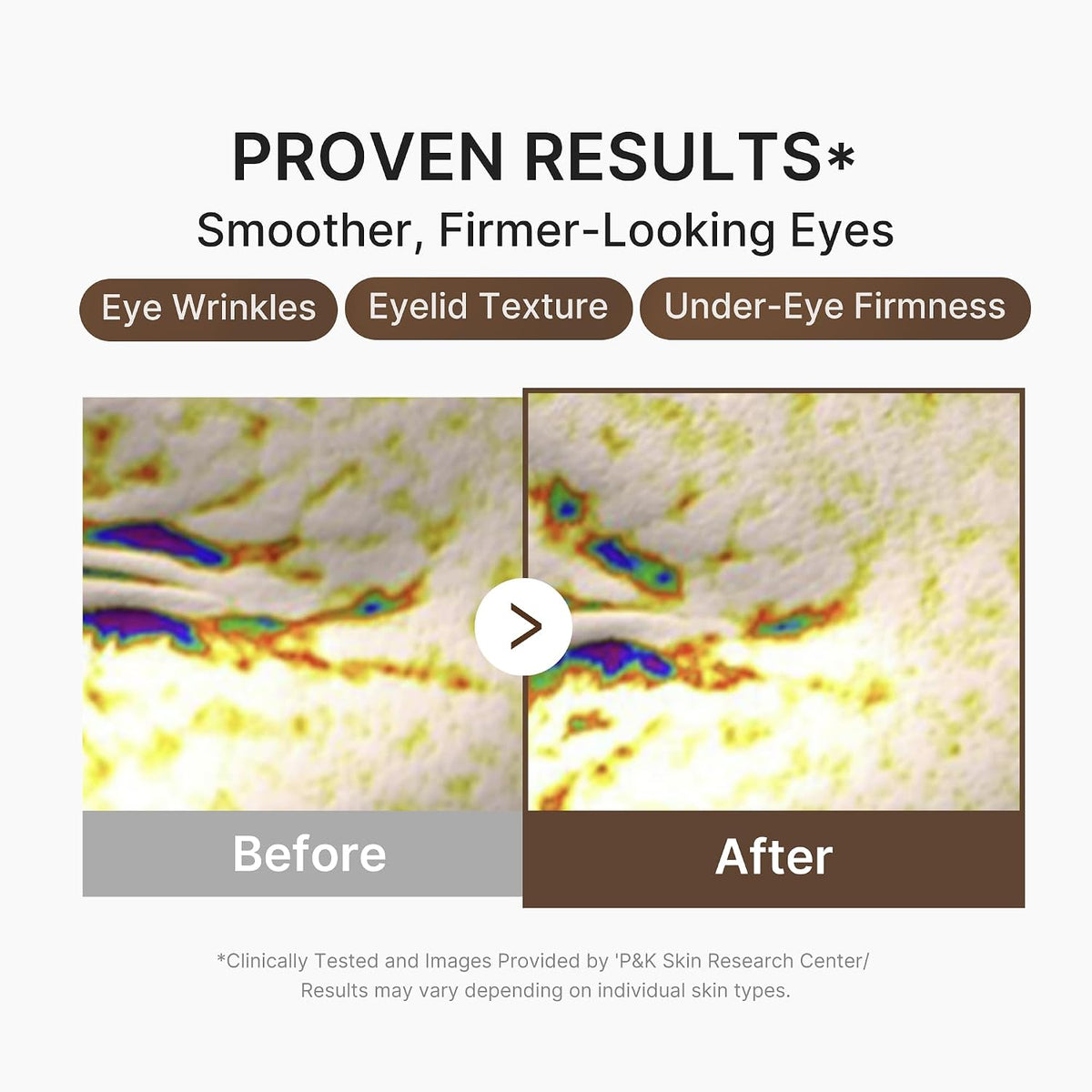 Eye Serum with Deep Reviving Peptide | Eye Treatment Serum with Multi Peptides, Niacinamide & Squalane | Reduces Signs of Aging and Fine Lines | Korean Skincare, 1.01 Fl.Oz