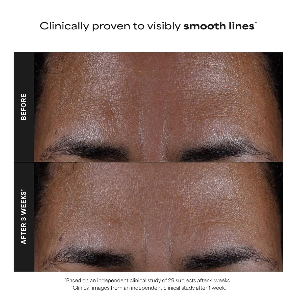Paula's Choice SKIN PERFECTING 2% BHA Liquid Leave-On Exfoliant