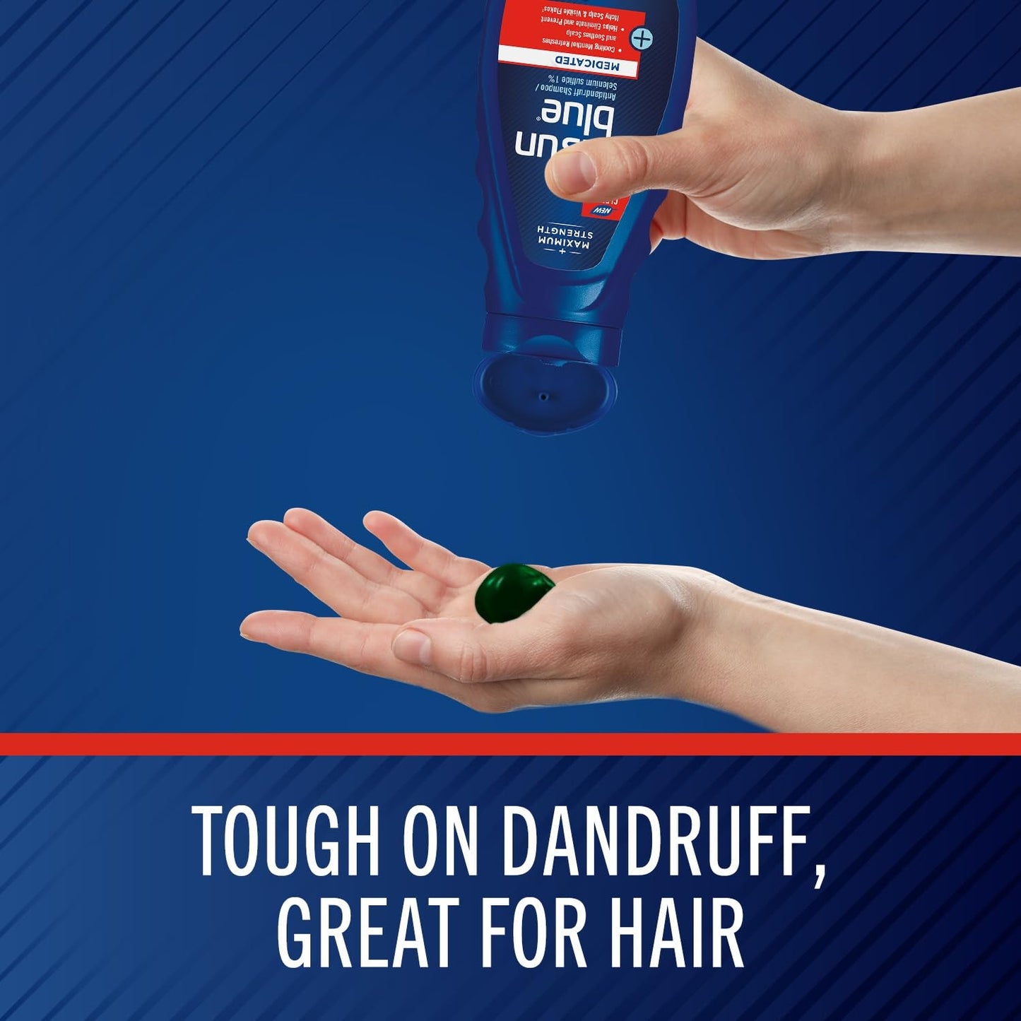 Medicated Antidandruff Shampoo, Maximum Strength Scalp Treatment with Selenium Sulfide, 11 Fl. Oz.