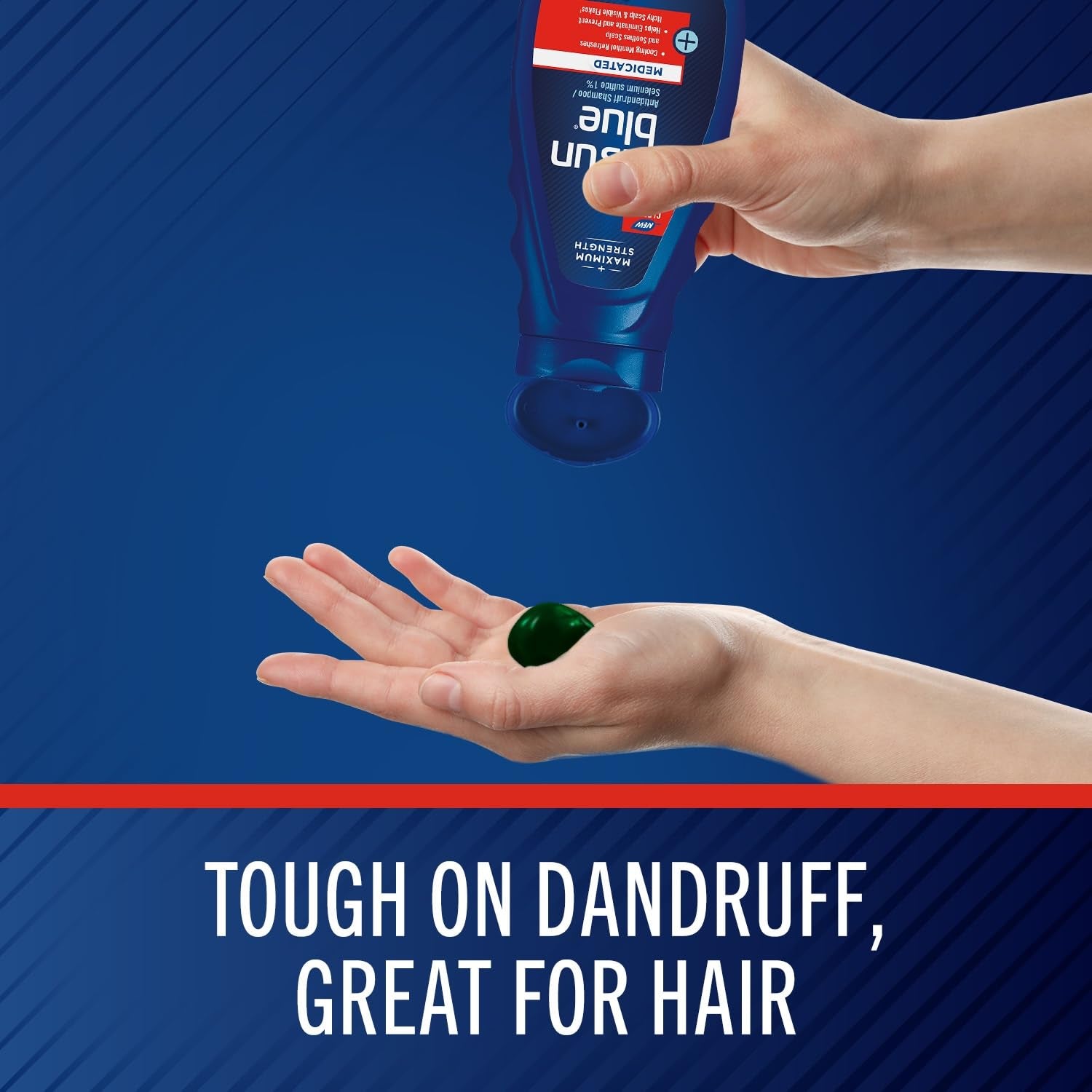 Medicated Antidandruff Shampoo, Maximum Strength Scalp Treatment with Selenium Sulfide, 11 Fl. Oz.